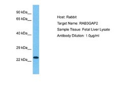 RAB3GAP2 Rabbit anti-Human, Polyclonal, Novus Biologicals 0.1ml; Unconjugated:Antibodies,